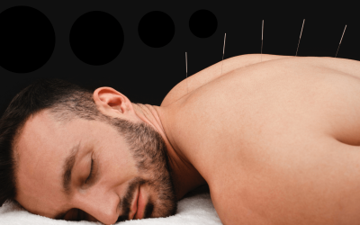 Acupuncture For Resilience: Improving Your Stress Response Through Traditional Chinese Medicine